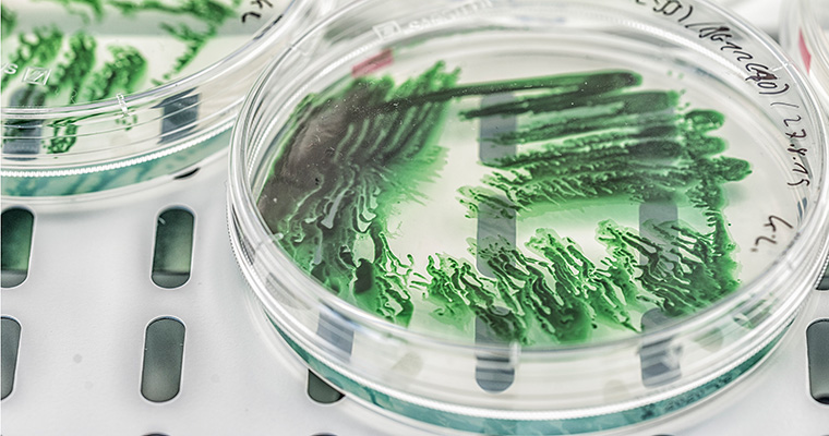 Cyanobacteria ©André Künzelmann/UFZ