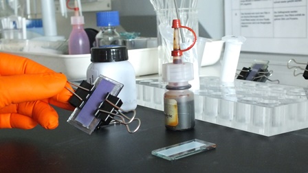 Die Gr&auml;tzelzelle