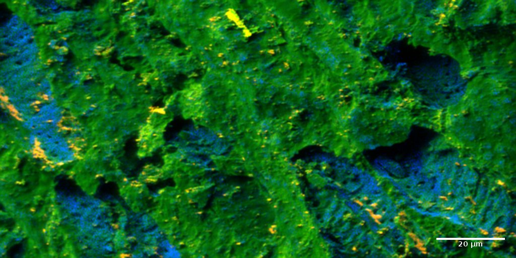 TiOx (yellow) and Ti (blue) in calcinated guava seed as seen by ToF-SIMS.
Sample: Dr. Mar&iacute;a P. Elizalde (BUAP, Mexico). Image: Dr. Hryhoriy Stryhanyuk, ProVIS, UFZ.