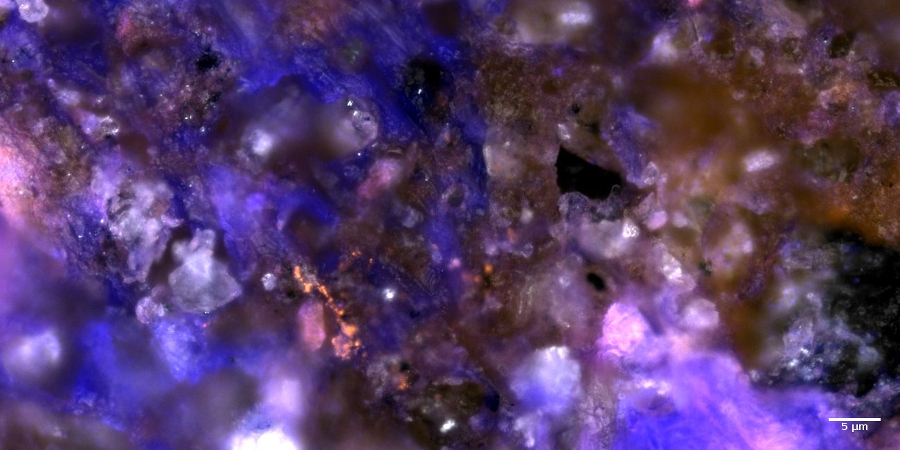 Bacteria in rhizosphere soil detected by catalyzed reporter deposition fluorescense in-situ hybridisation.
Sample & Image: Dr. Chaturanga Bandara, Dr. Niculina Musat