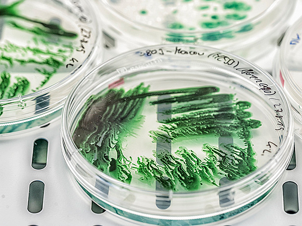 Kultur und Zucht von Cyanobakterien in Petri-Schalen. Foto: Andr&eacute; K&uuml;nzelmann /UFZ