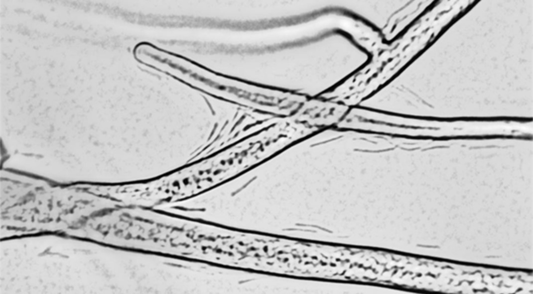 'Fungal pipeline' - Hyphae sustain the growth of bacteria in the hyphosphere by cytoplasmic streaming and release of nutrients 
(&copy; Anja Worrich/UFZ)